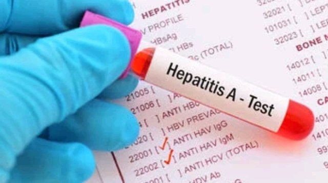 Apakah Penyakit Hepatitis Akut Menular?_womanindonesia.co.id